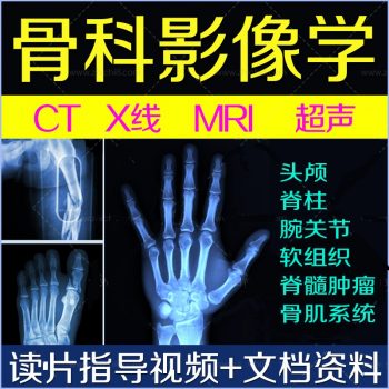【骨科影像学诊断视频教程】脊柱胸腰椎间盘突出骨科读片阅片指导百度网盘下载-中医教程博客
